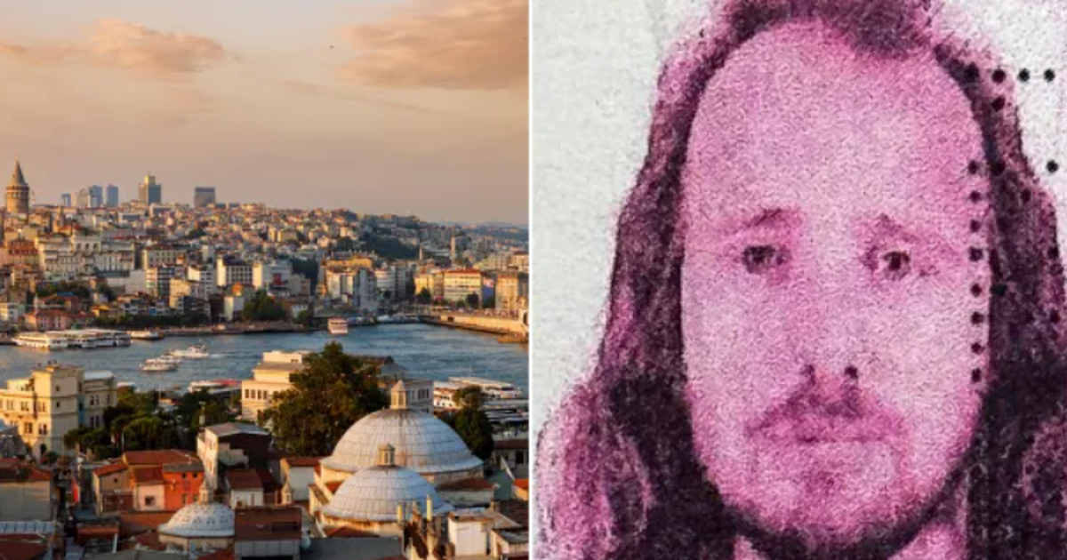 Bëri transplant të flokëve dhe trajtim dentar  humb jetën 36 vjeçari shqiptar në Turqi