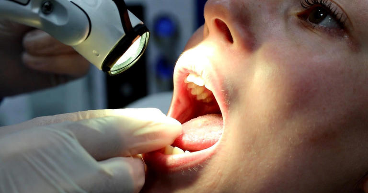 Kanceri i gojës  Shenjat që nuk duhet t i injoroni