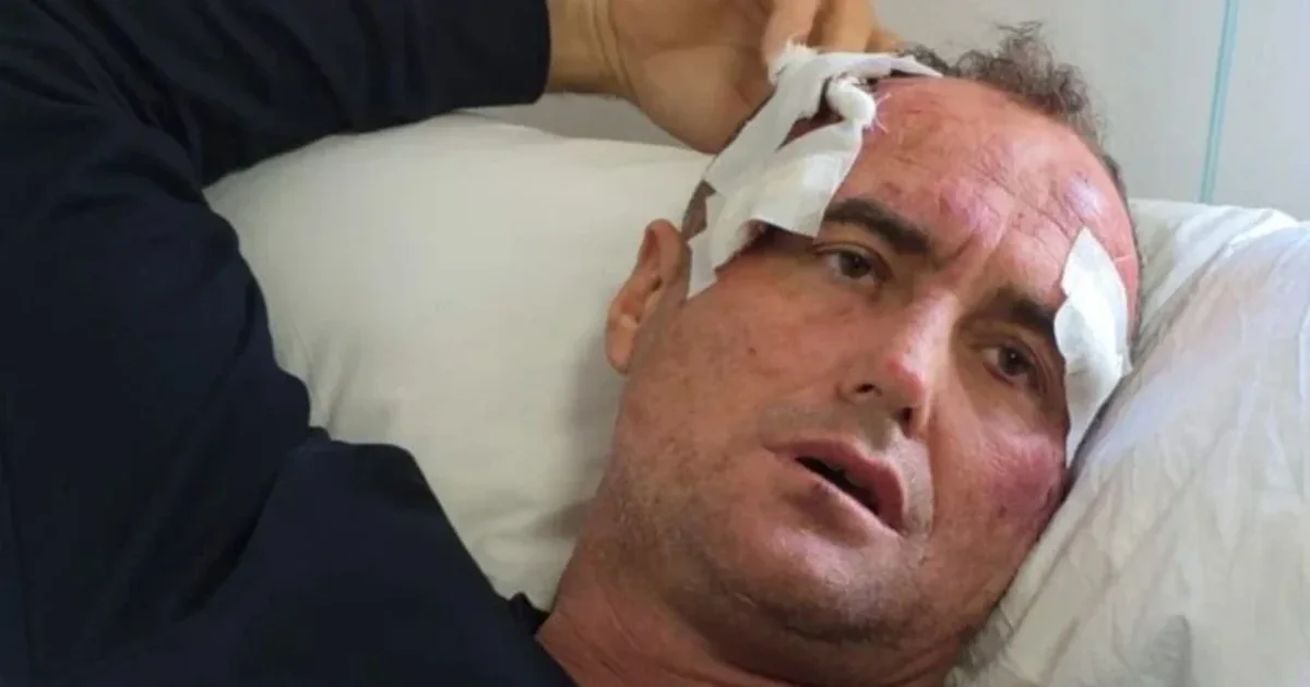  Më dhunuan në shtëpinë time njerëz me uniformën e policisë   reagon sërish 46 vjeçari nga Fieri  Dua drejtësi