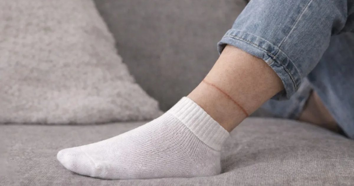 Nëse çorapet ju lënë SHENJA kjo NUK po ndodh nga ËNJTJA  por nga   