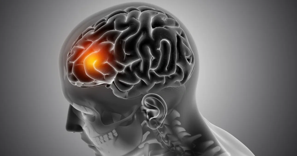  Tërmetet në tru  që mund të ndryshojnë atë që dimë për skizofreninë