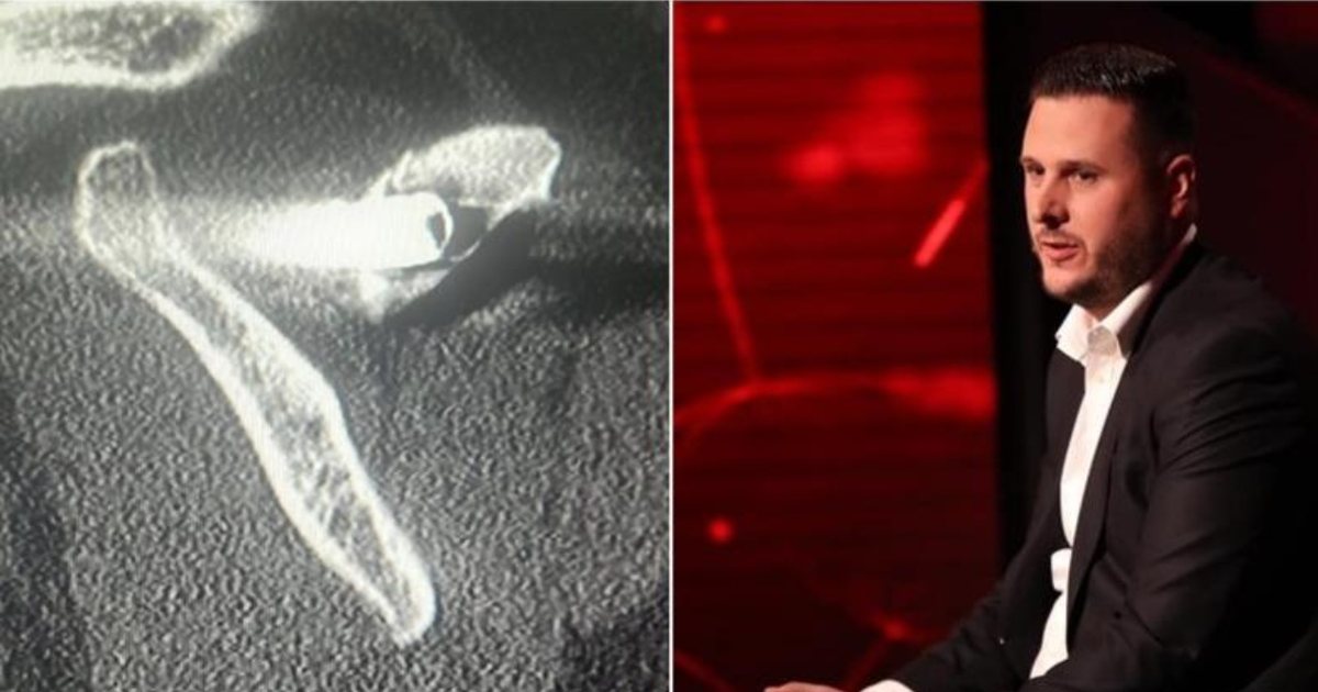  27 vite me plumb në trup   I mbijetuari i masakrës së Suharekës rrëfen tmerrin nga serbët