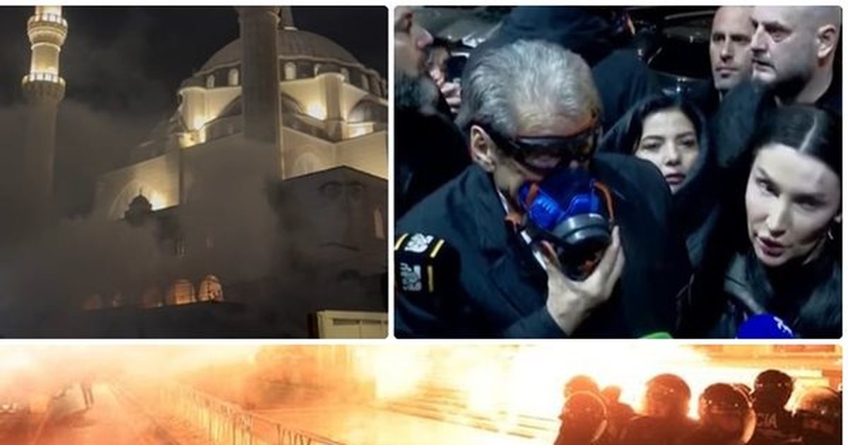 U qëllua në kokë  protestuesi përfundon te Trauma  probleme me shikimin