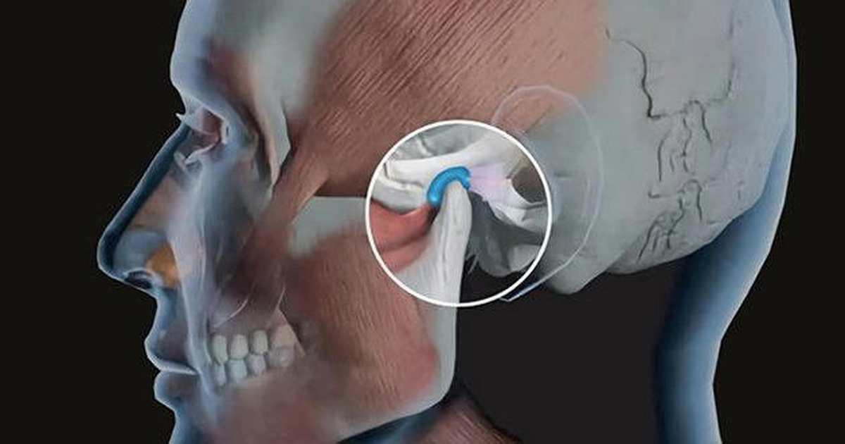  Dhimbja e nofullës   shkaqe të pazakonshme që nuk duhet t i injoroni