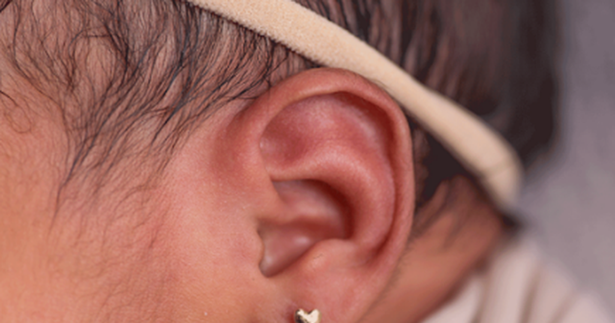 E vogël në dukje  por me pasoja  Ja çfarë mund t i ndodhë foshnjës pas shpimit të veshëve   