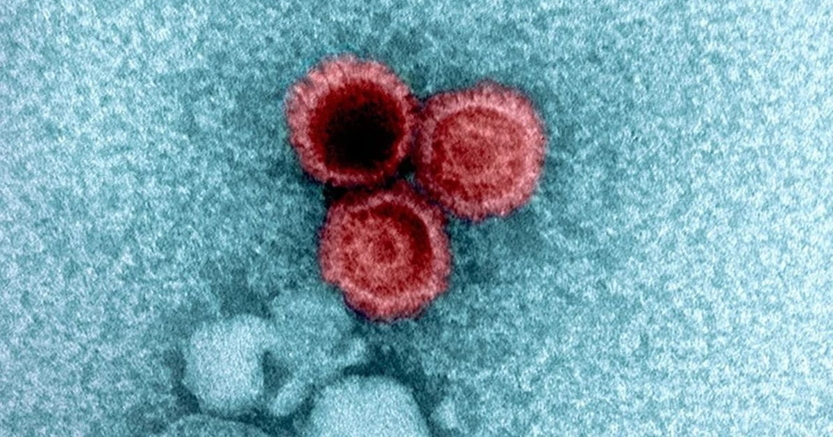 Nga Epstein Barr te herpeset   studimi shpjegon pse disa viruse nuk largohen kurrë nga trupi