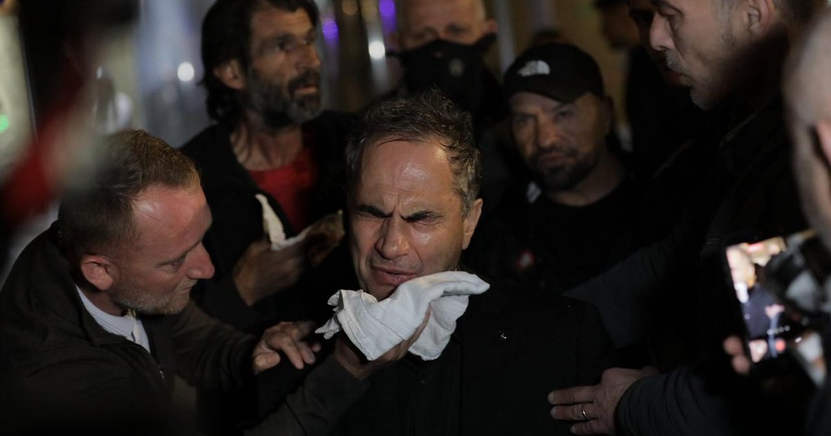 Protesta e Berishës  4 të lënduar transportohen te  Trauma   Mes tyre 1 efektiv policie  Luçiano Boçi dhe Kalaja