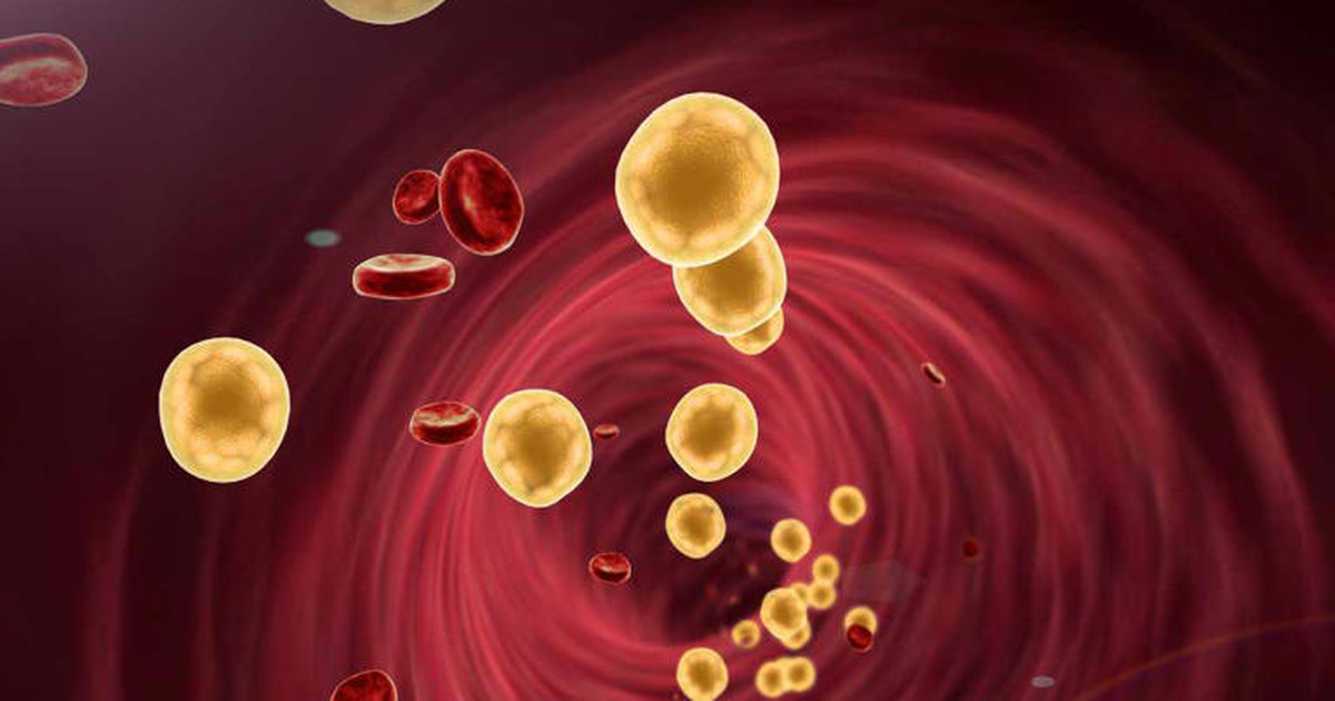 Çfarë nuk duhet të pini në mëngjes për të ulur kolesterolin 