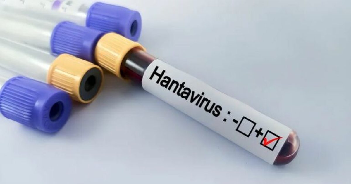 Hantavirus në anijen turistike  A do të kemi një pandemi të re  Çfarë dihet për virusin që përhapet nga brejtësit