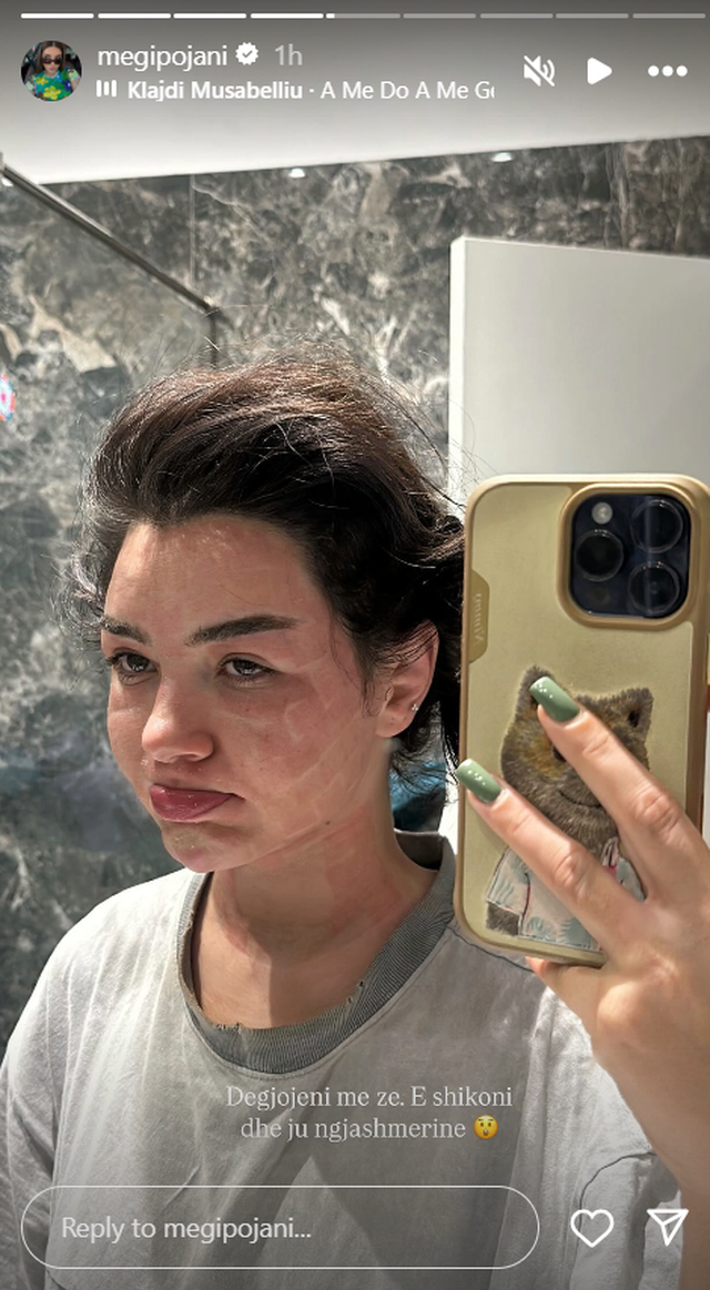 Foto/ Çfarë ndodhi me moderatoren? Megi Pojani në gjendje jo