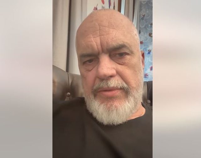 Rama i përgjigjet komentuesit: Lexo regjistrat e shtetit, sot jemi 300