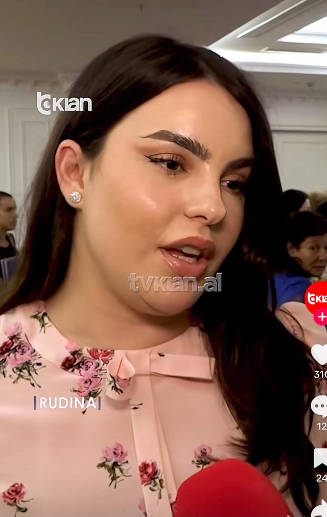 Foto/ Rrjeti "shpërthen" në komente, dalja e fundit e Armina