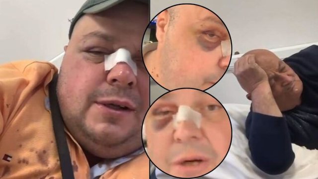Dhunoi Genard Hajdinin dhe babain e tij në lokal, procedim penal për