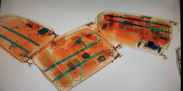 Ndalohen pajisjet për transplantin e flokëve në Aeroportin