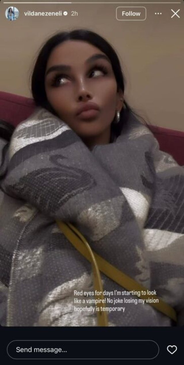 FOTO/ Modelja e njohur shqiptare tregon problemin me sytë, rrezikon