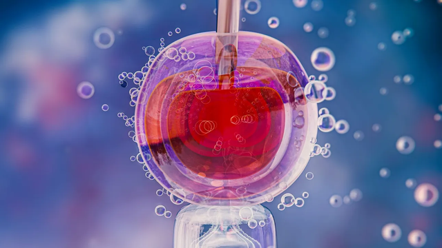 Fertilizimi in vitro, zhvillimet m&euml; t&euml; fundit q&euml; po