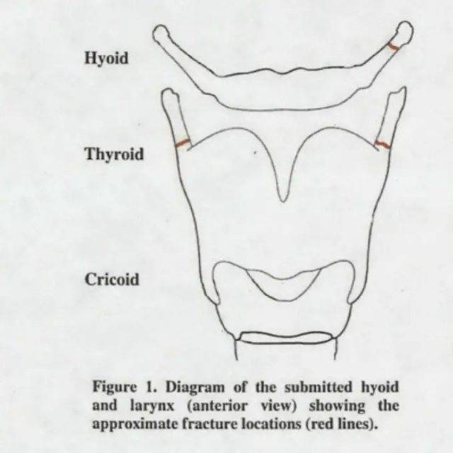 E mbytën apo u vetëvra? Misteret rreth vdekjes së Epstein, mjeku