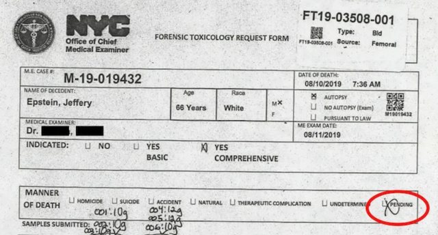 E mbytën apo u vetëvra? Misteret rreth vdekjes së Epstein, mjeku