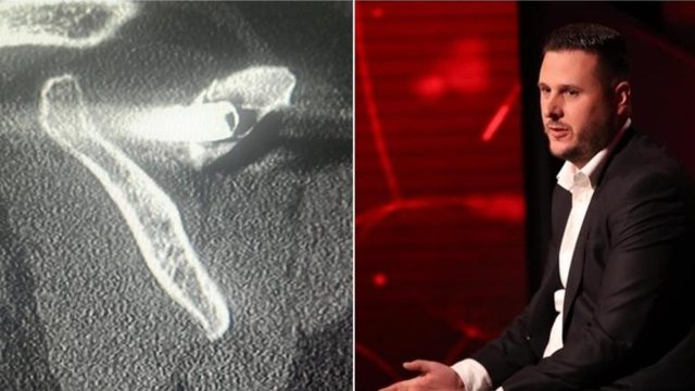 "27 vite me plumb n&euml; trup&rdquo;/ I mbijetuari i masakr&euml;s s&euml;