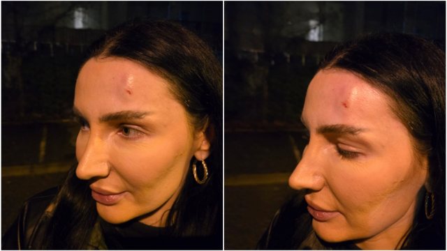 Protesta e opozit&euml;s/ L&euml;ndohet ish-kandidatja e PD n&euml;