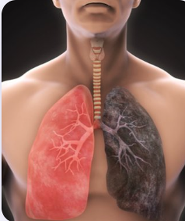 'Mushk&euml;ri kokoshka', s&euml;mundja misterioze q&euml; prek