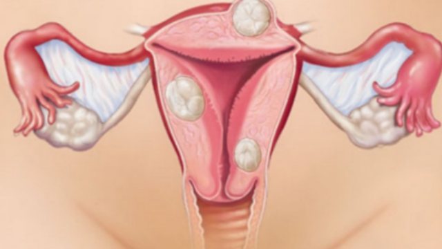 Alarm p&euml;r grat&euml;? K&euml;to masa t&euml; fshehta n&euml; mit&euml;r