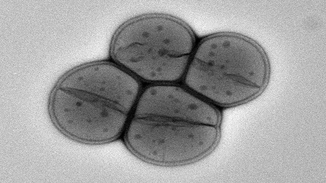 Mikrobet q&euml; ikin nga nj&euml; planet n&euml; tjetrin: D&euml;shmi t&euml;