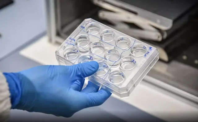 Shqiptarja n&euml; Itali vdes pas diagnoz&euml;s s&euml; gabuar, 300 mij&euml;