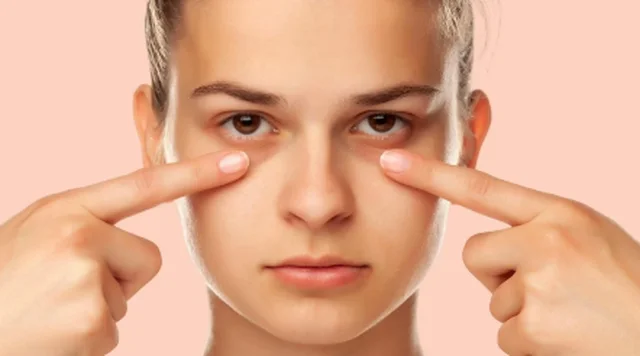 Rrath&euml;t n&euml;n sy/ Si t'i parandaloni dhe largoni nga fytyra juaj