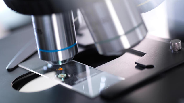 Jet&euml;gjat&euml;sia varet m&euml; shum&euml; nga gjenetika apo nga stili i