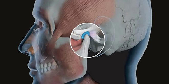 &ldquo;Dhimbja e nofull&euml;s &ndash; shkaqe t&euml; pazakonshme q&euml; nuk