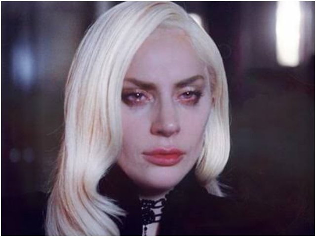 Lady Gaga n&euml; gjendje t&euml; r&euml;nd&euml; sh&euml;ndet&euml;sore?/Ylli i