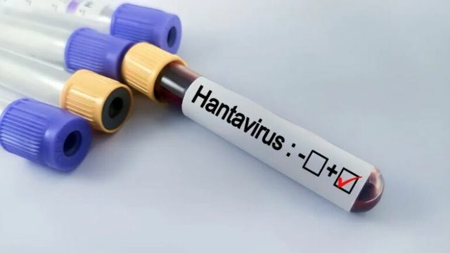Hantavirus n&euml; anijen turistike/ A do t&euml; kemi nj&euml; pandemi t&euml;