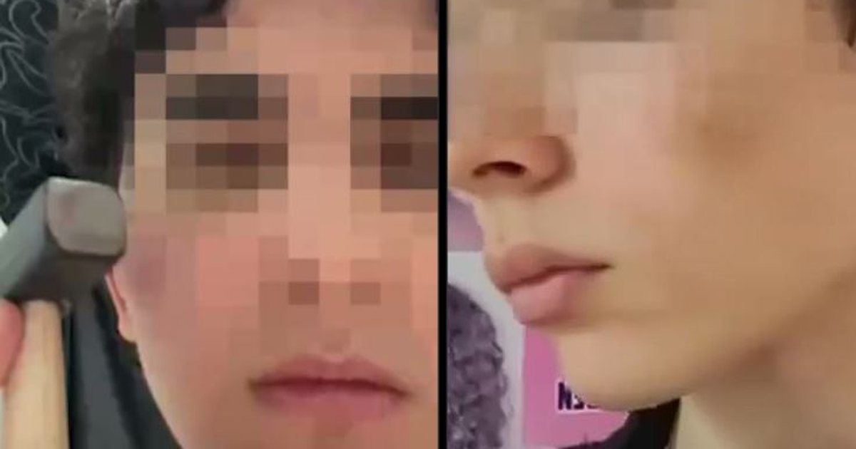 Trendi i rrezikshëm që po përhapet tek të rinjtë  godasin fytyrën  ka një arsye